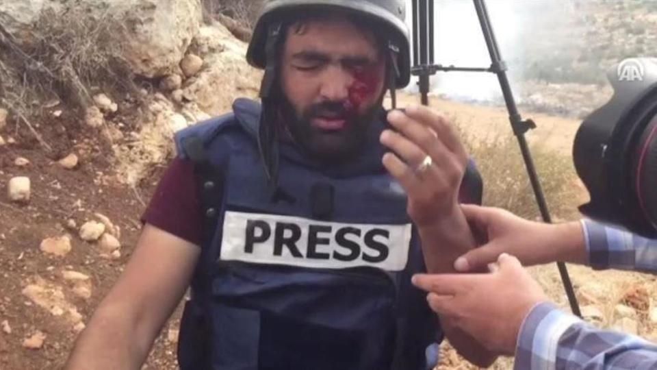 معاذ عمارنة يقول إن الاحتلال يسعى لطمس الحقيقة من خلال استهدافه للصحافيين