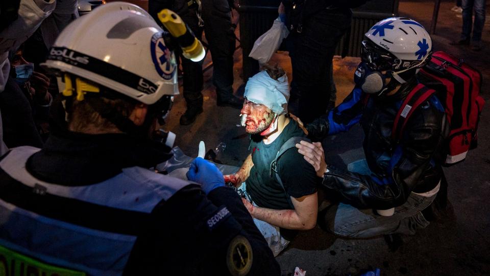 فرق الإنقاذ تحيط بالمصور السوري أمير الحلبي بعد اعتداء الشرطة الفرنسية عليه خلال تغطيته مظاهرات باريس 